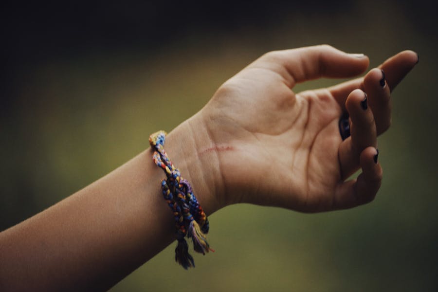 A close-up of a hand wearing colorful friendship bracelets, showing a scar on the wrist.